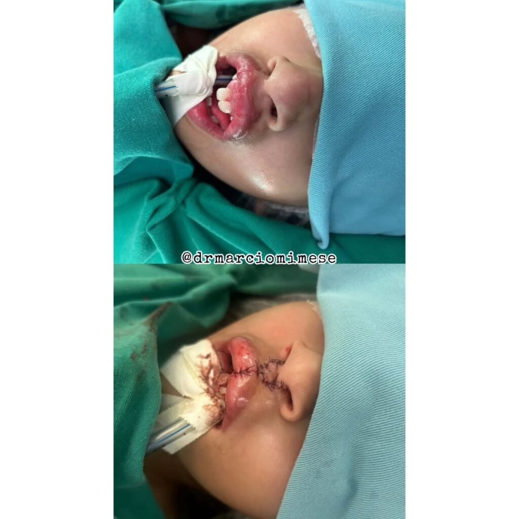 Instagram post from drmarciomimese. This post is in position 1.