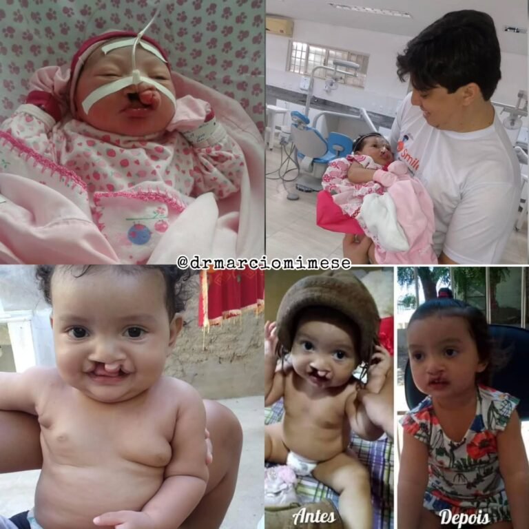 Instagram post from drmarciomimese. This post is in position 3.